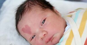 Baby werd in 2015 wereldberoemd dankzij z’n hartvormige moedervlek