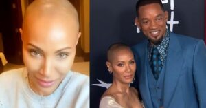 Jada Pinkett-Smith onthult dat alopecia haar kaal heeft gemaakt