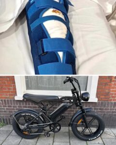 Vader waarschuwt anderen voor fatbikes na zware val zoon: “Lag huilend op de grond van de pijn”