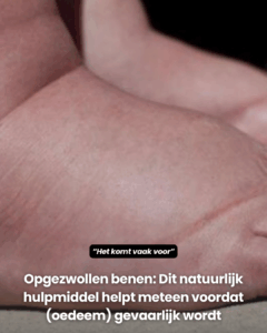 Dit natuurlijk hulpmiddel helpt meteen voordat (oedeem) gevaarlijk wordt