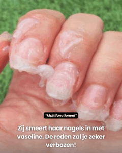De reden zal je zeker verbazen!