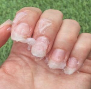Zij smeert haar nagels in met vaseline. De reden zal je zeker verbazen!