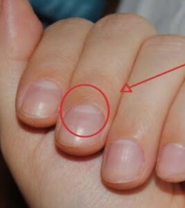 Dit zeggen de halve maantjes op je nagels écht over je gezondheid