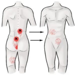 6 simpele rekoefeningen om rug- en zenuwpijn snel te verlichten