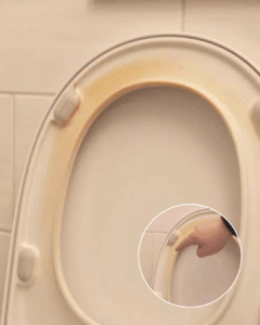 Toiletbril vergeeld? Met deze huismiddeltjes wordt hij weer spierwit