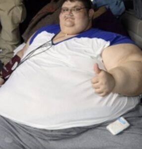 Zwaarste man ter wereld verliest 334 kilo en is onherkenbaar geworden…