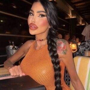 Ze gaf 200.000 euro uit aan plastische chirurgie omdat ze niet tevreden was over haar uiterlijk (+foto van hoe ze er vroeger uitzag)